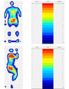 Pressure and distribution imaging
